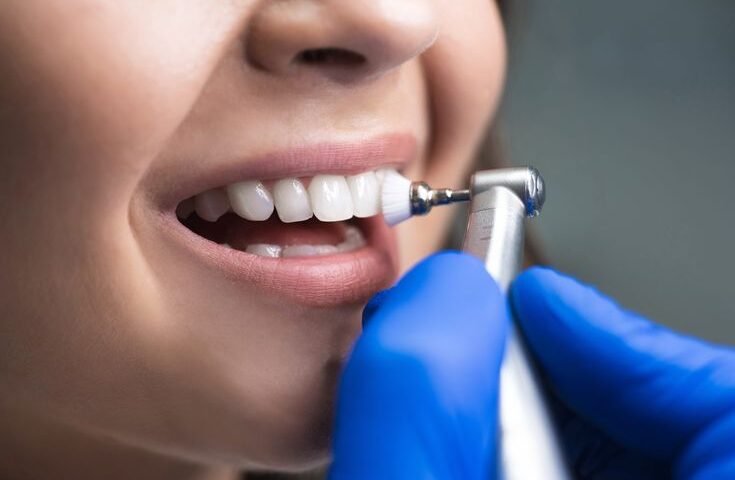 Kids teeth cavity causes, solutions, and prevention tips for healthy smiles