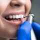 Kids teeth cavity causes, solutions, and prevention tips for healthy smiles